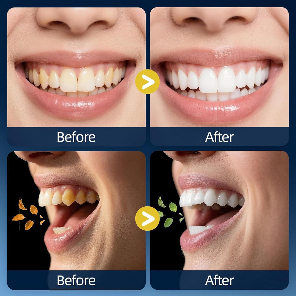Before and after comparison of teeth whitening with visual elements on a blue background.